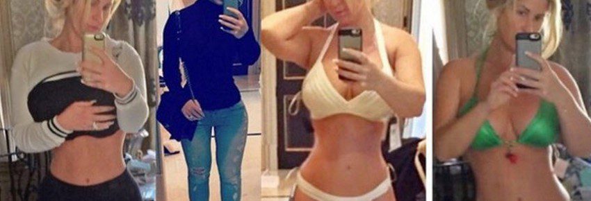 San Diego Body Contouring | Plastic Surgery