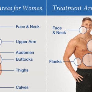lipo areas
