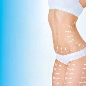 liposuction in san diego on many parts of body