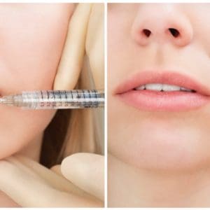 patient receiving Botox and dermal fillers injections