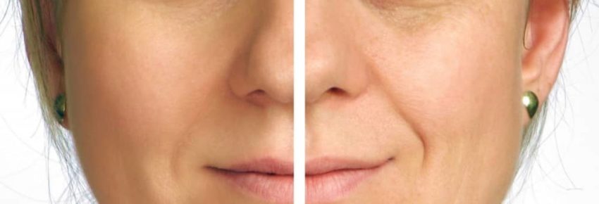 San Diego Body Contouring | Plastic Surgery