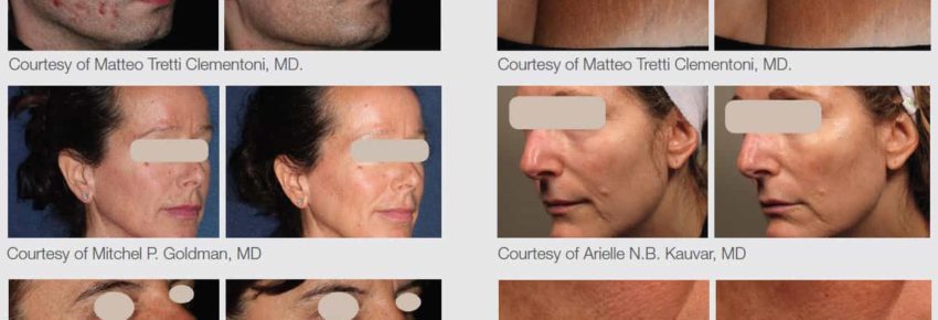 San Diego Body Contouring | Plastic Surgery