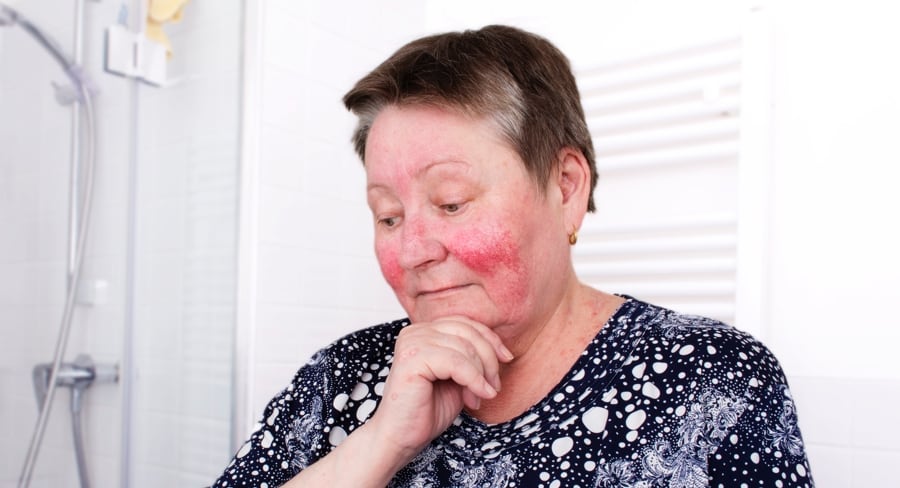 Reduce Redness, Age Spots, and Blood Vessels