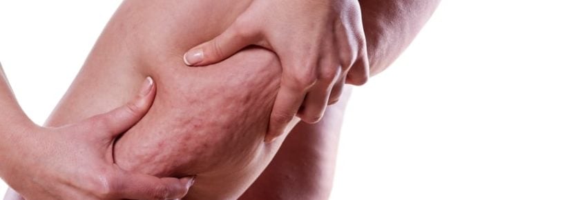 San Diego Body Contouring | Plastic Surgery