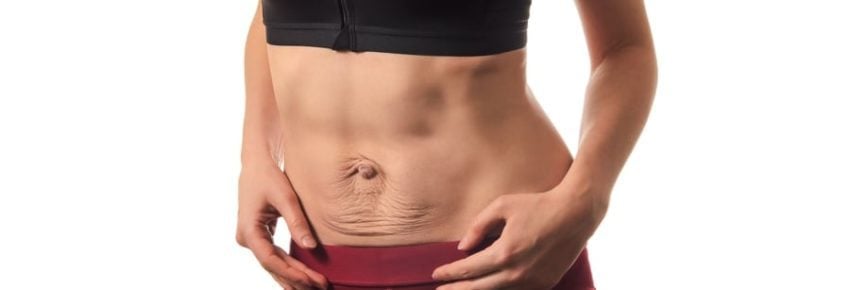 San Diego Body Contouring | Plastic Surgery