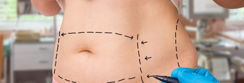 San Diego Body Contouring | Plastic Surgery