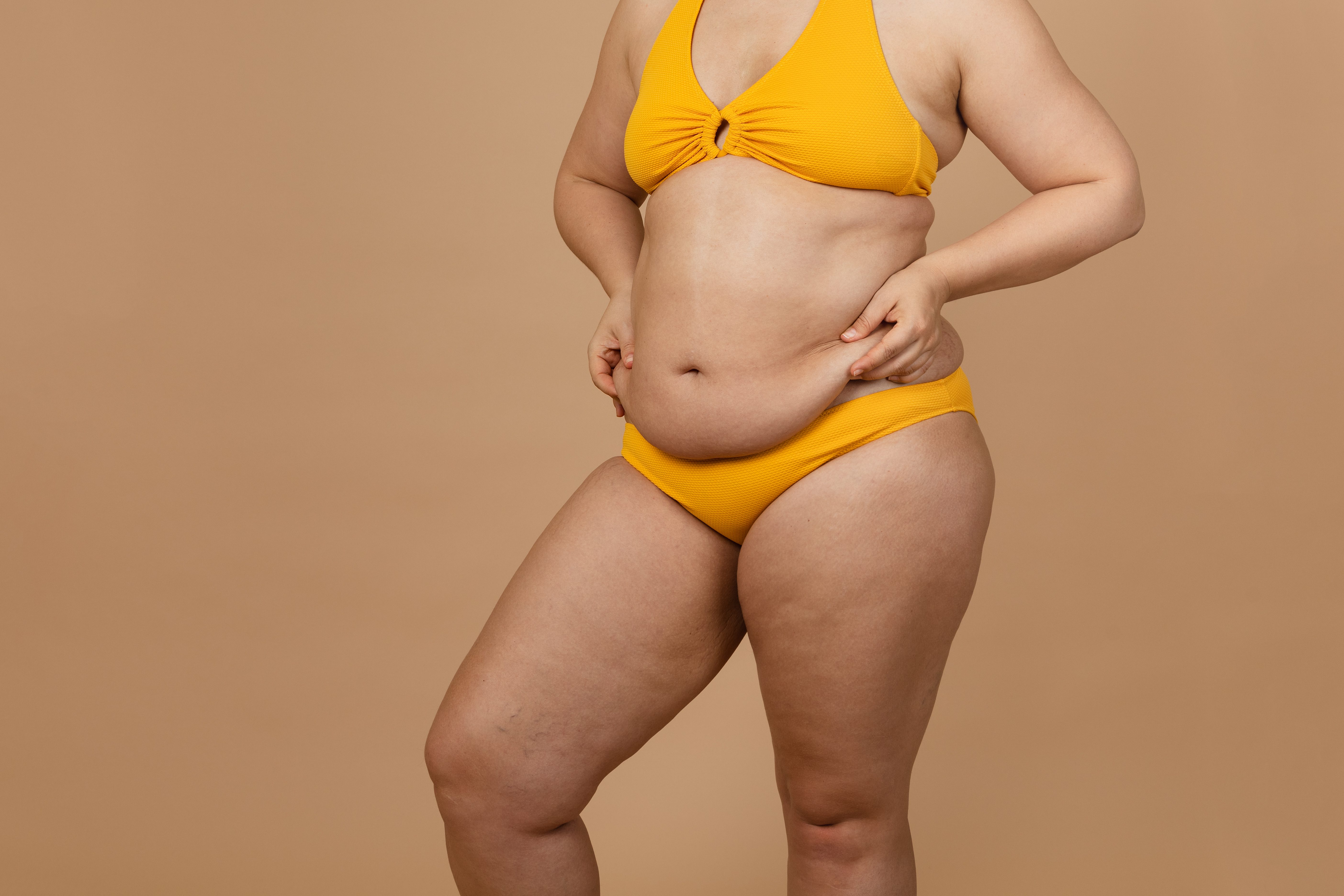 Tummy Tuck in San Diego: Your Path to a Sculpted Midsection