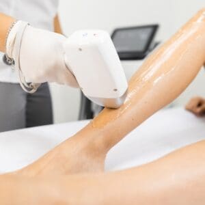 Laser hair removal process for woman's legs