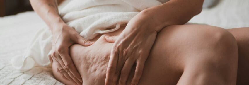 Close-up of female body with cellulite, woman makes massage against cellulite with her hands.