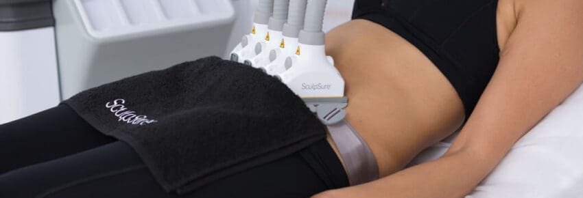 culpSure treatments