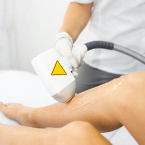 Laser hair removal of female legs close up