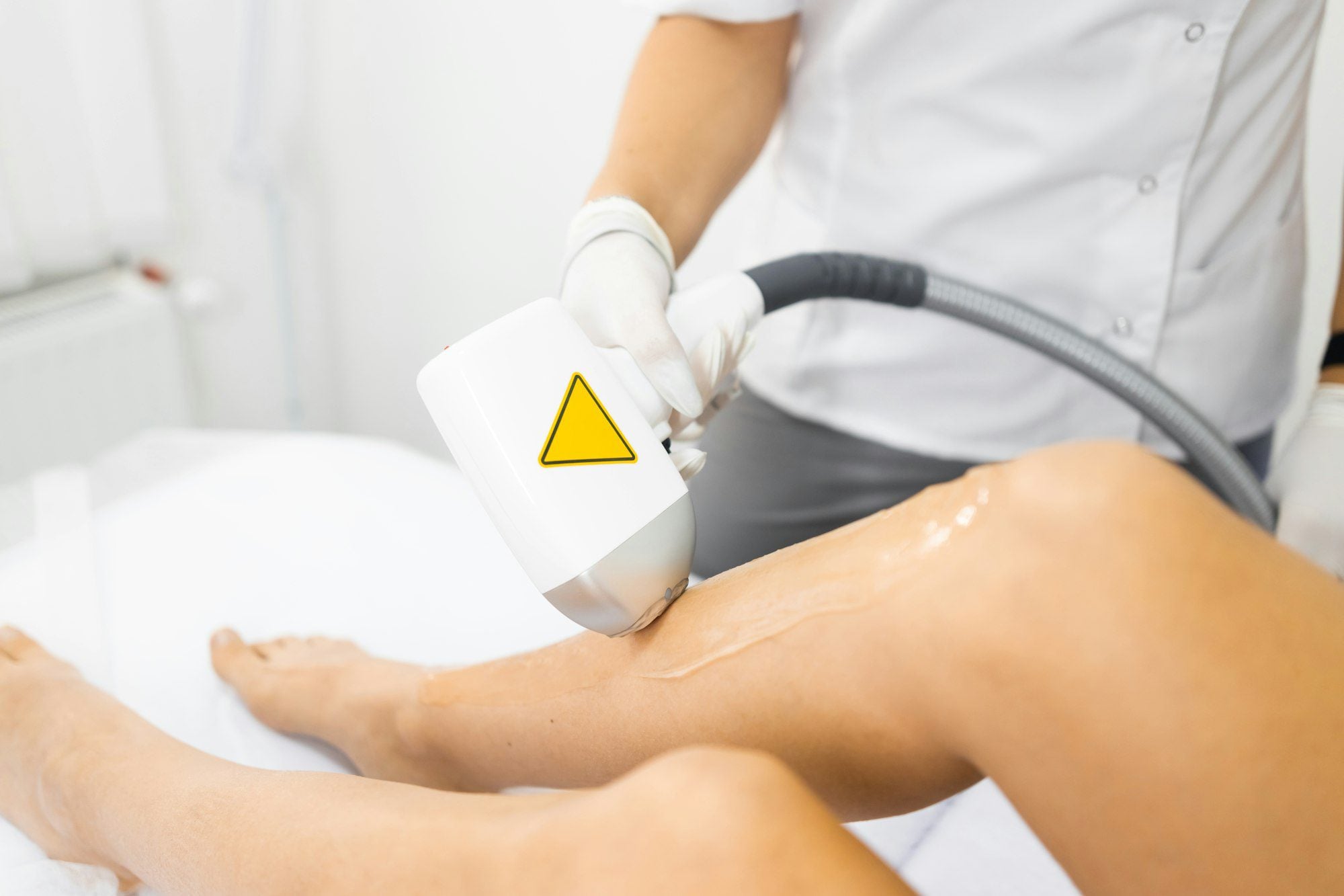 Why Laser Hair Removal in San Diego Is the Preferred Choice for Smooth Skin