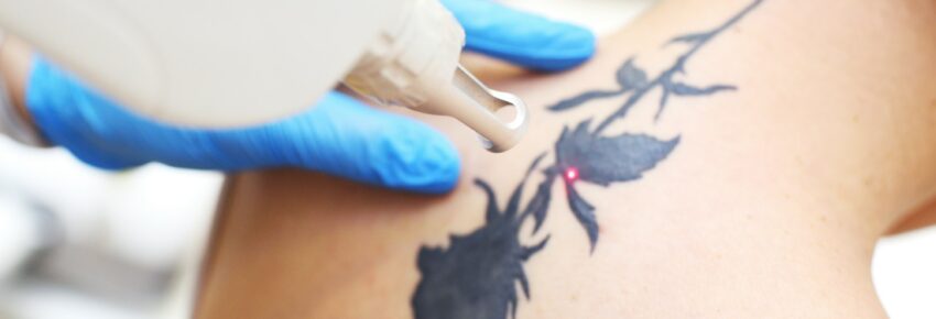 San Diego Body Contouring | Plastic Surgery