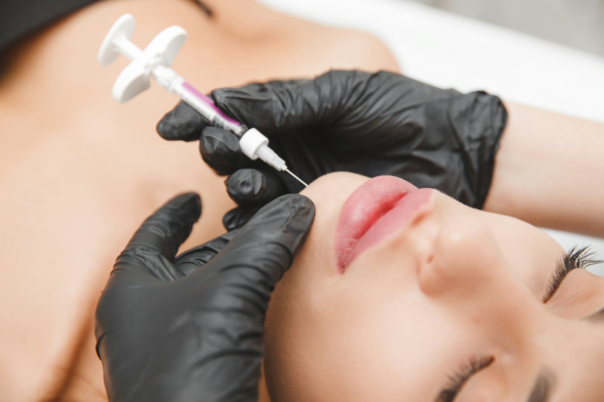 Kybella Chin Fat Removal San Diego: Latest Cosmetic Innovations