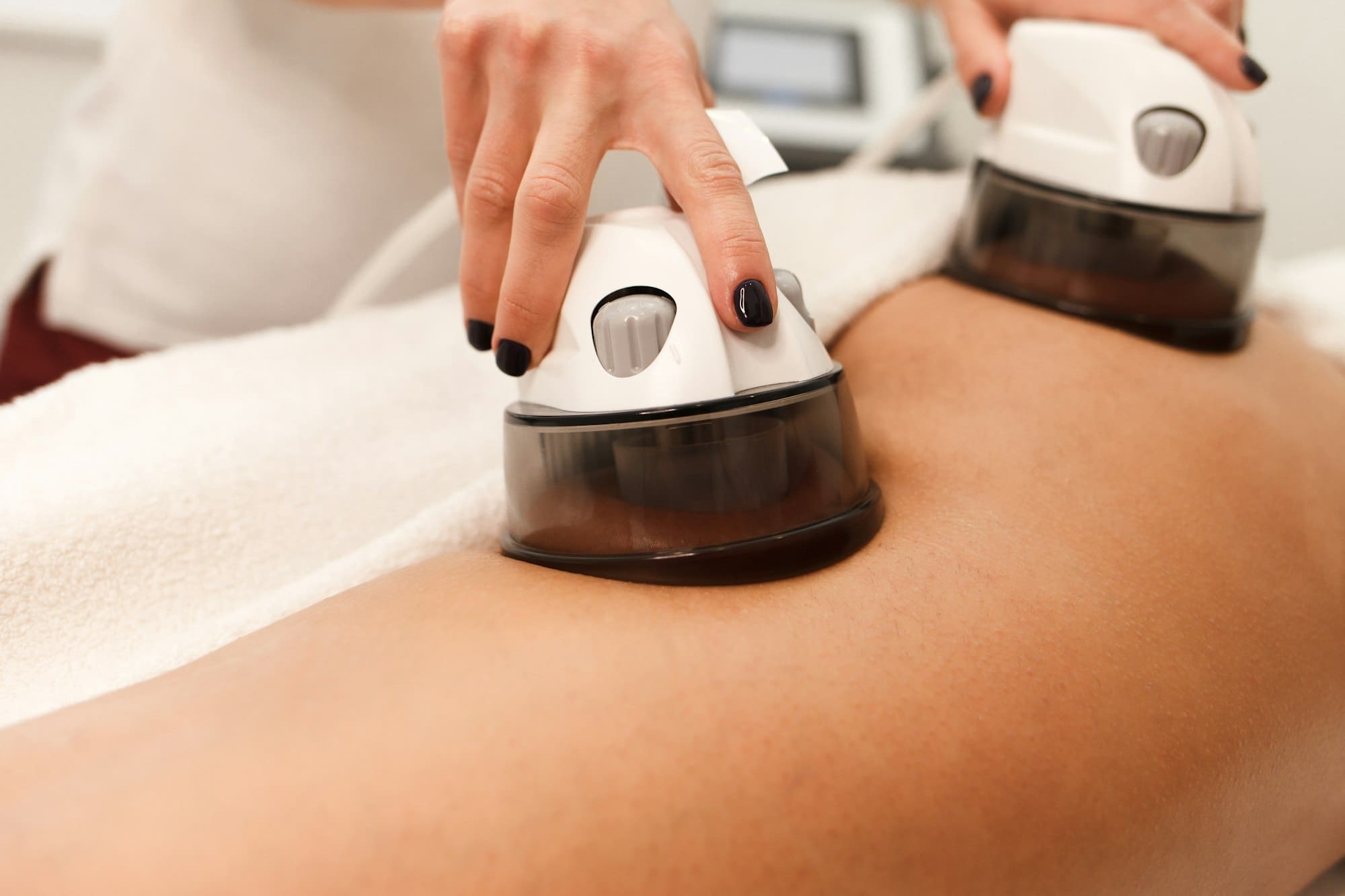 The Top 5 Reasons to Consider Liposuction in San Diego