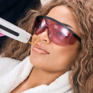 Woman on mustache laser hair removal procedure