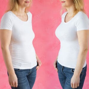 Woman before and after breast enhancement plastic surgery