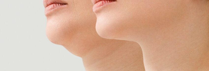 San Diego Body Contouring | Plastic Surgery