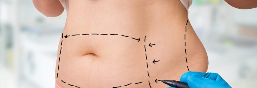 San Diego Body Contouring | Plastic Surgery