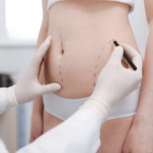 Intent good plastic surgeon consulting his patient on liposuction