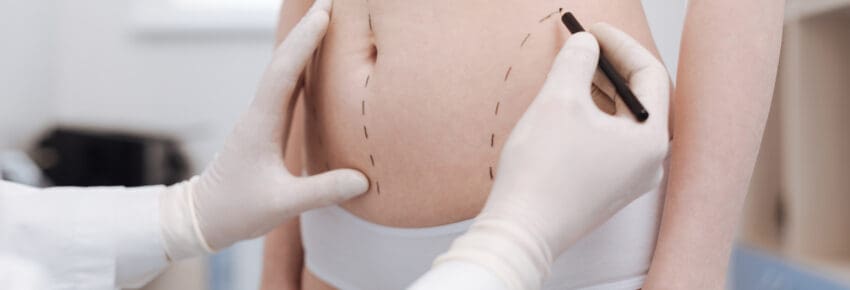 Intent good plastic surgeon consulting his patient on liposuction
