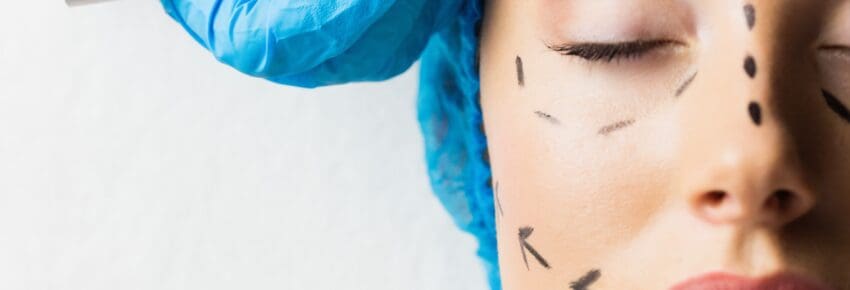 Peaceful young patient with dotted lines on the face