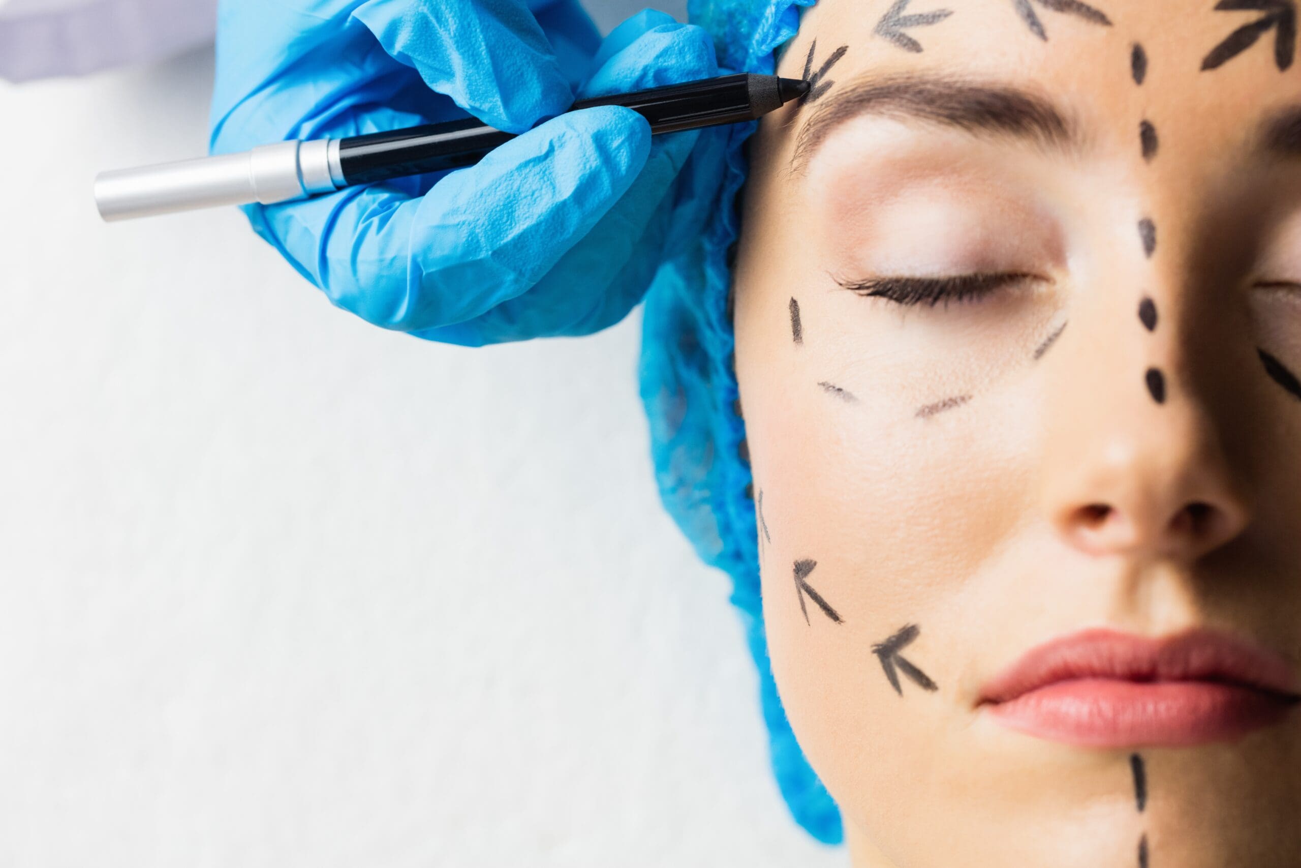 Peaceful young patient with dotted lines on the face